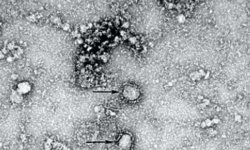 Российский ученый рассказал как нейтрализовать коронавирус